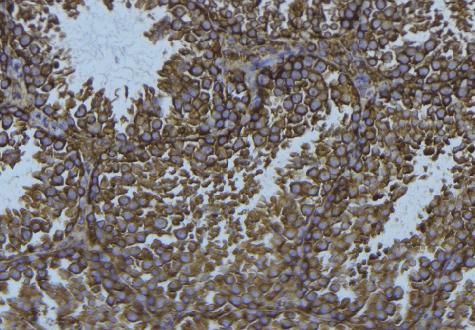 Polyclonal Rabbit anti-Human PDIA3 / ERp57 Antibody (IHC, IF, WB)