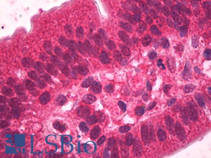 IHC-plus™ HNF4A / HNF4 Antibody (aa2-15)