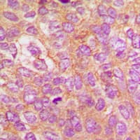 IKBKB / IKK2 / IKK Beta Antibody (phospho-Tyr188)