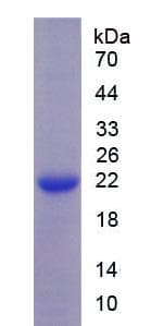 Human SLC12A3 / TSC Protein (Recombinant His)