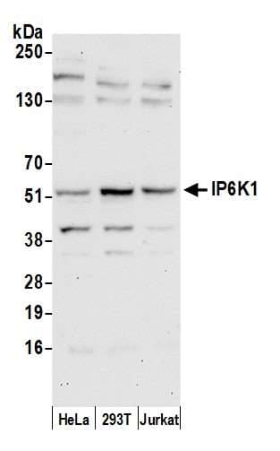 IP6K1 Antibody (aa75-125)
