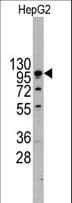 IHC-plus™ CDH4 / R Cadherin Antibody (aa175-203)