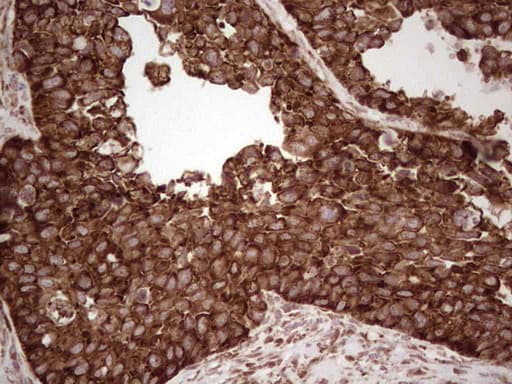 Monoclonal Mouse anti-Human YBX1 / YB1 Antibody (clone OTI11A7, IHC, WB)