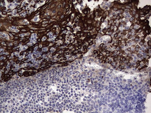 Monoclonal Rat anti-Human Acidic Cytokeratin Antibody (clone 9H3, IHC)