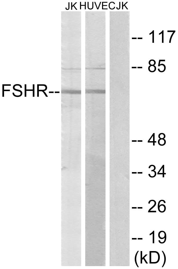 FSH Receptor / FSHR Antibody (aa211-260)