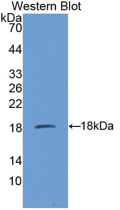 CBT1 / SDHD Antibody (aa1-159)