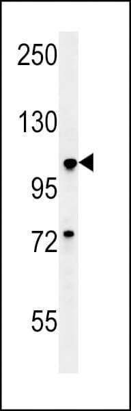BUB1 Antibody (aa1-30)
