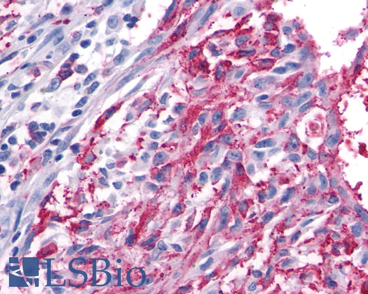 PathPlus™ FZD5 / Frizzled 5 Antibody (Cytoplasmic Domain)