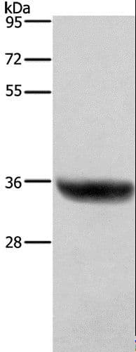 HSD17 / HSD17B1 Antibody