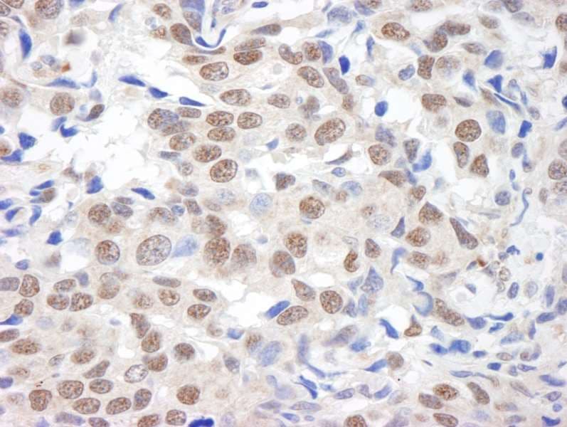 KDM1A / LSD1 Antibody (aa825-C-term)