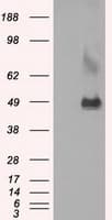 LOX / Lysyl Oxidase Antibody (clone OTI6B7)