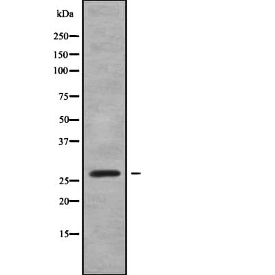Polyclonal Rabbit anti-Human RABL2B Antibody (WB)