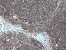 VBP1 Antibody (clone OTI1D1)