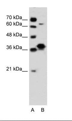 Polyclonal Rabbit anti-Human FRA-1 / FOSL1 Antibody (aa130-179, IHC, WB)