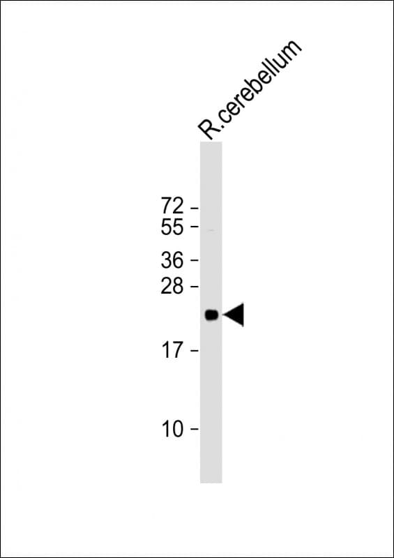 CD81 Antibody (clone 1668CT270.93.9)
