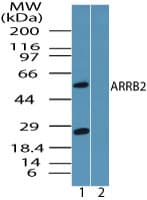 IHC-plus™ Polyclonal Rabbit anti-Human ARRB2 / Beta Arrestin 2 Antibody (aa23-40, IHC, WB)
