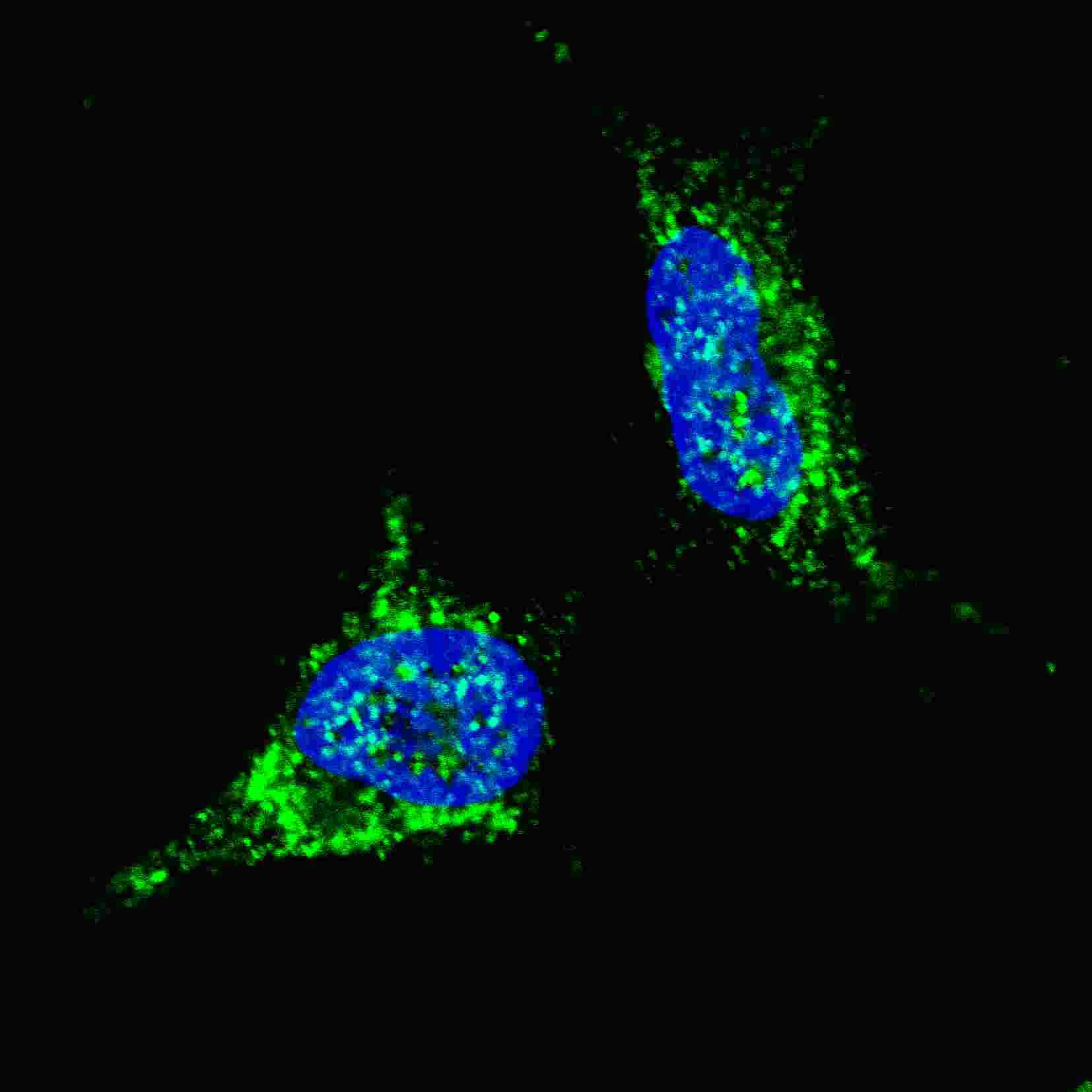 IHC-plus™ Polyclonal Rabbit anti-Human LIN28B Antibody (aa1-30, IHC, IF, WB)