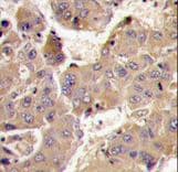 PIK3R3 / p85 Gamma Antibody (aa316-346)