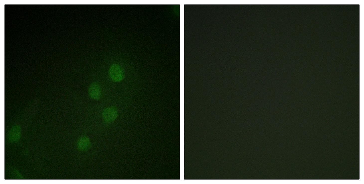 MYF5 / MYF 5 Antibody (p49)