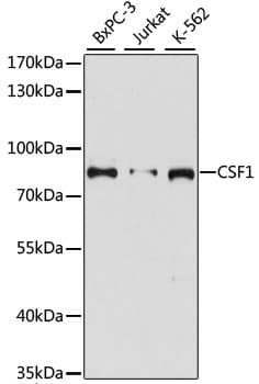 CSF1 / MCSF Antibody