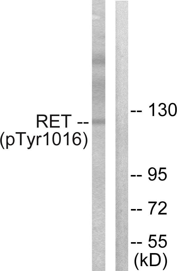 Polyclonal Rabbit anti-Human RET Antibody (phospho-Tyr1015, WB)