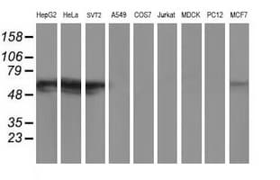 GBA3 / CBG Antibody (clone OTI4F10)