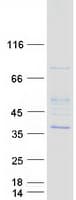 Human HUS1 Protein (Recombinant Myc-DDK (Flag))