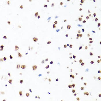 H1F0 Antibody