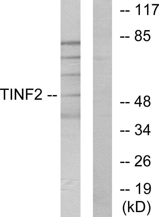 TINF2 Antibody