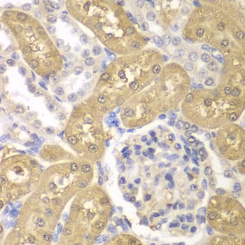 Polyclonal Rabbit anti-Human AKR1A1 Antibody (IHC, IF, WB)