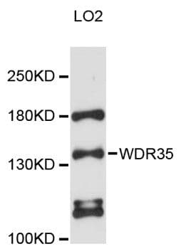 WDR35 Antibody
