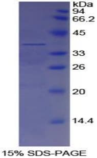 Human APOH / Apolipoprotein H (Recombinant His)
