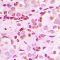 Polyclonal Rabbit anti-Human SP1 Antibody (phospho-Thr453, IHC, IF, WB)