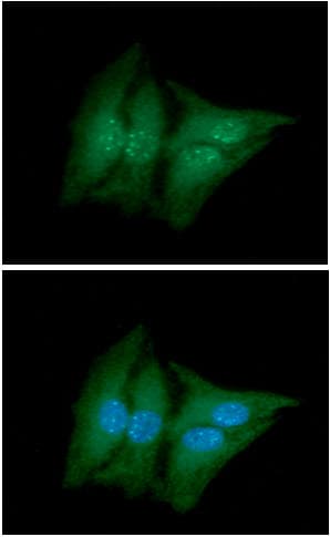 ACY1 / Aminoacylase 1 Antibody (clone AT1E2)