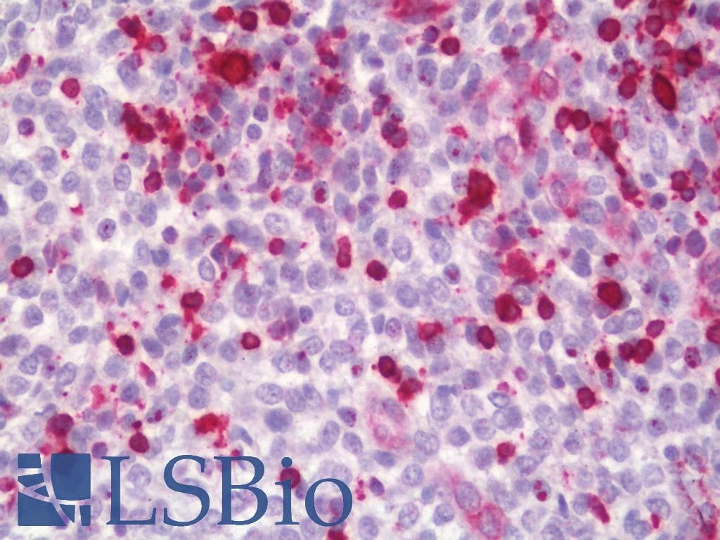 IHC-plus™ HSD11B1 / HSD11B Antibody (aa1-50)