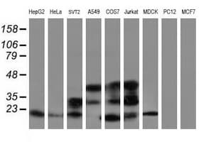 Monoclonal Mouse anti-Human ARL2BP / BART Antibody (clone OTI1F8, IHC, WB)