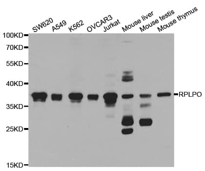 RPLP0 Antibody