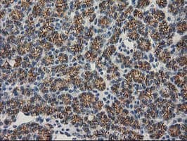 CTNNB1 / Beta Catenin Antibody (clone OTI1E10, Carrier-free)