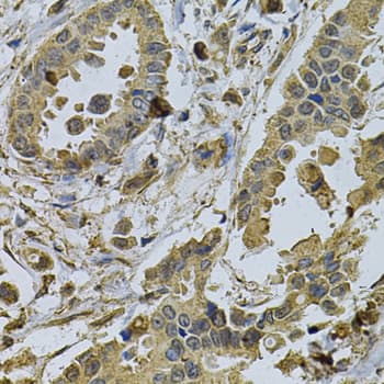 HMG-CoA Reductase / HMGCR Antibody