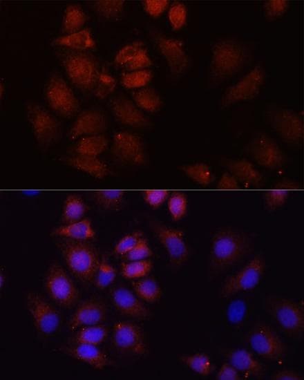 HRNR / Hornerin Antibody