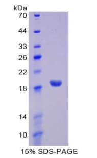 Mouse DeltaSIP Protein (Recombinant His-T7)