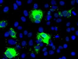 SHH / Sonic Hedgehog Antibody (clone OTI10H6)