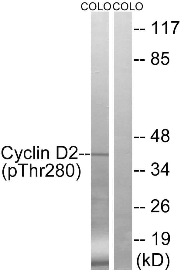 CCND2 / Cyclin D2 Antibody (phospho-Thr280)