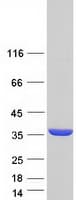 Human TPM3 Protein (Recombinant Myc-DDK (Flag))