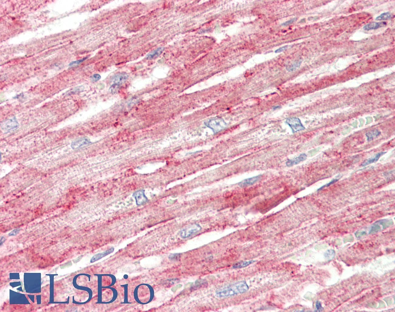 FLII / FLI Antibody (aa1116-1165)
