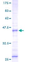 Human NMU / Neuromedin U Protein (Recombinant GST)