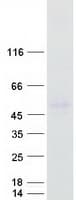 Human ZDHHC11 Protein (Recombinant Myc-DDK (Flag))