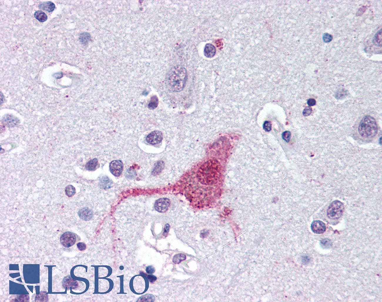 IHC-plus™ EDNRB / Endothelin B Receptor Antibody (N-Terminus)