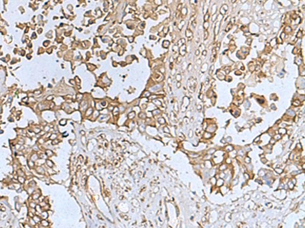TREM1 Antibody