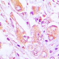 MRPS35 Antibody (Internal)